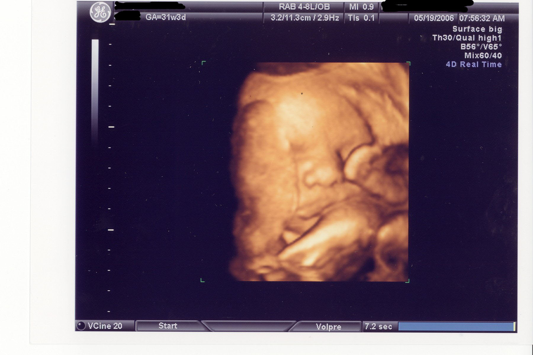 Your Ultrasound – Difference Between 2D, 3D and 4D Ultrasounds