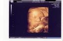 4D ultrasound, 31-week boy