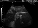28 week girl ultrasound, gender said to be boy