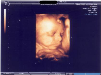 Ultrasound Baby Pictures on Your Ultrasound     Benefits Of 3d And 4d Baby Ultrasounds