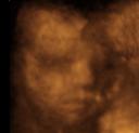 4D ultrasound, 29-week boy 1