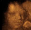 4D ultrasound, 29-week boy 2