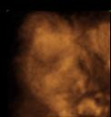 4D ultrasound, 29-week boy 3