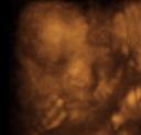 4D ultrasound, 29 week boy 4