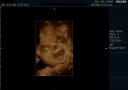 3D ultrasound of 24 week boy baby #4