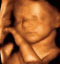 3D ultrasound of boy 2